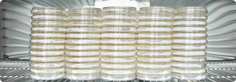  Nutrient agar in petri dishes 