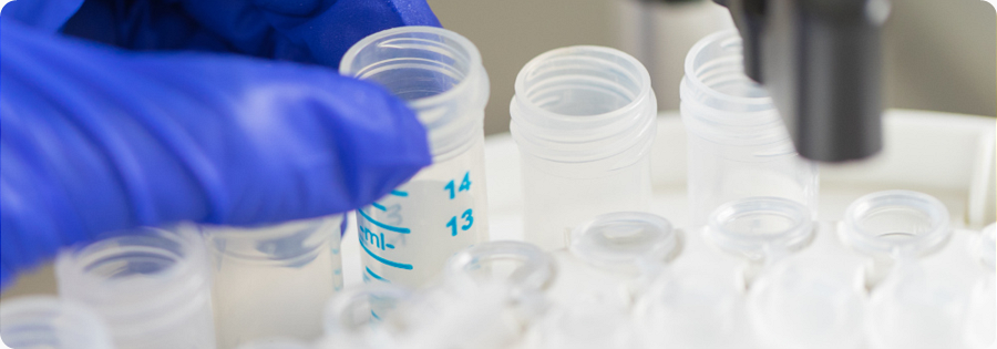  Protein purification 